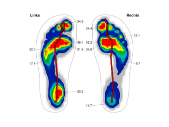 Dynamische Fußdruckmessung